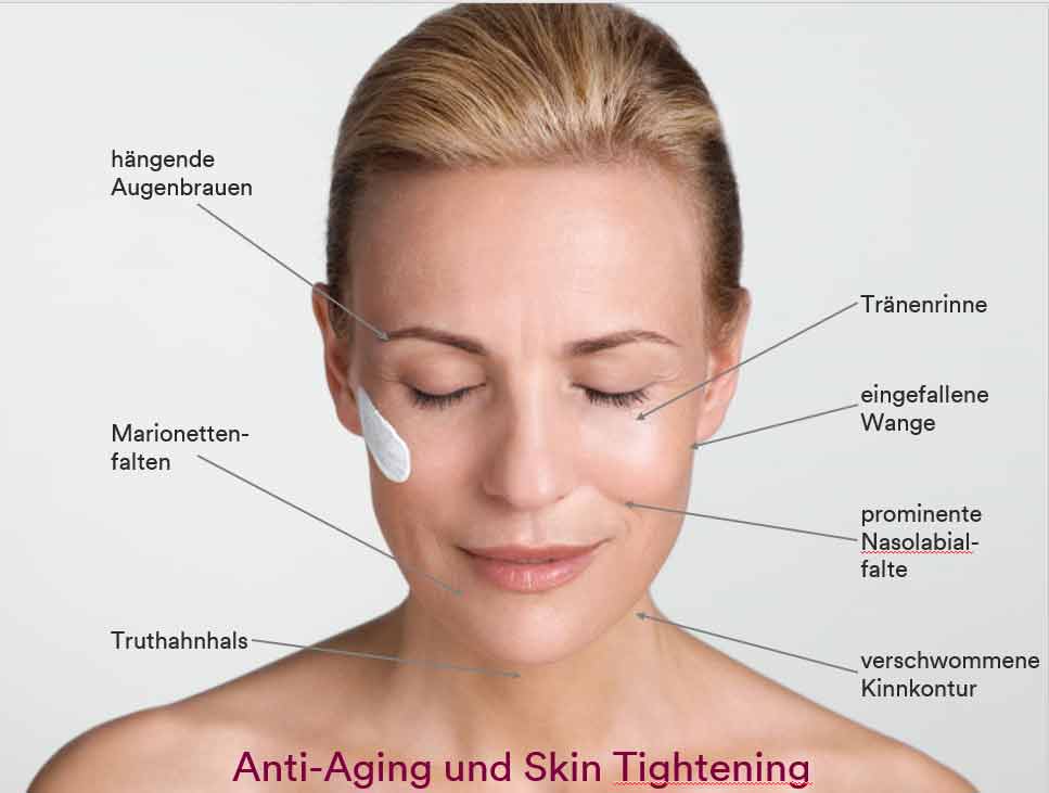 Anti Aging Skin Tightening mit Reviderm in Berlin Steglitz